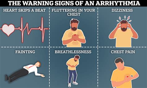 arrhythmia symptoms dizziness